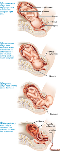 Positions of the baby and placenta during the three stages of delivery.